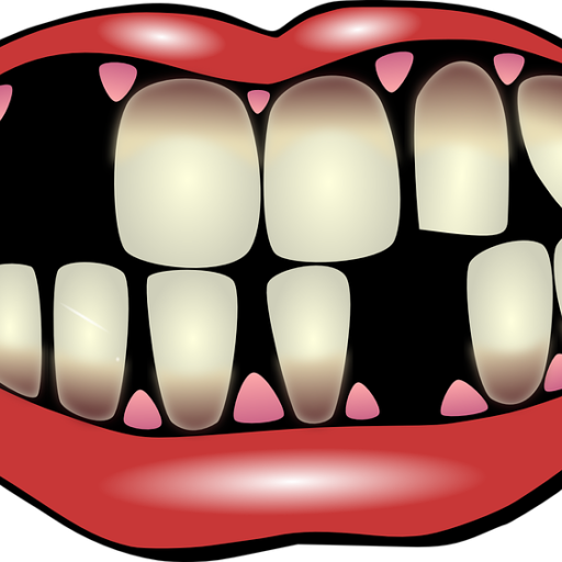 Kvalitní náhrada ztracených zubů? Zubní implantáty!